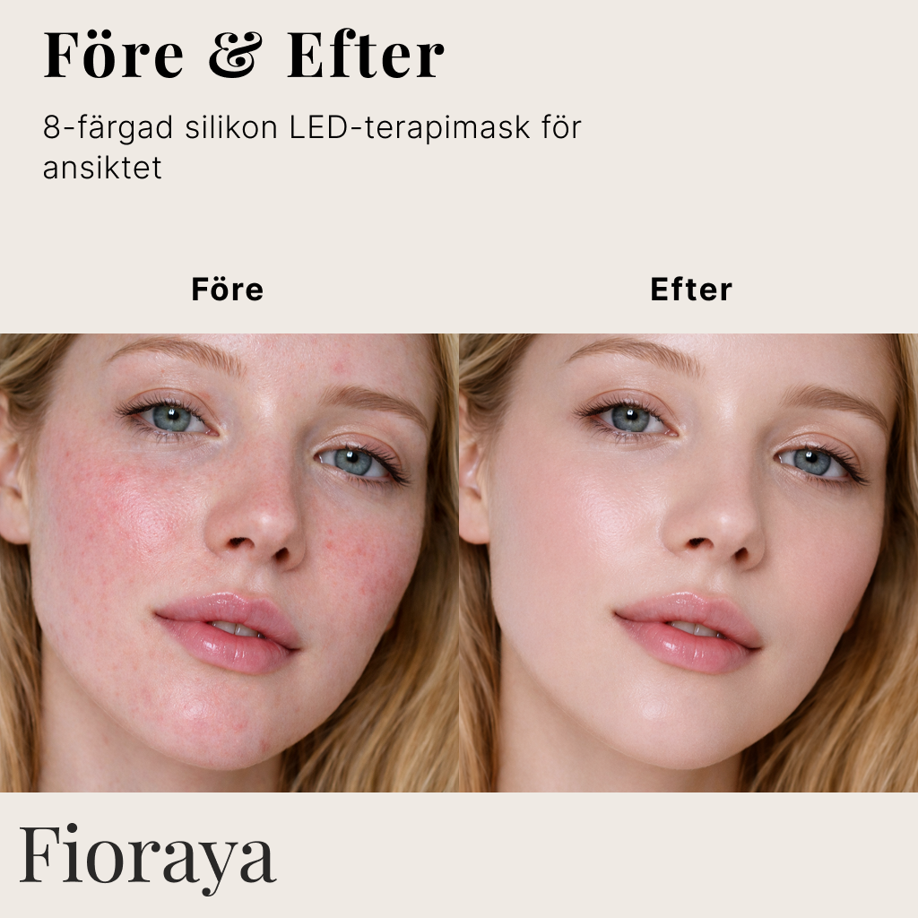 LED-Terapimask